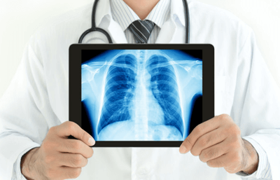 أشعة عادية رقمية وبالصبغة