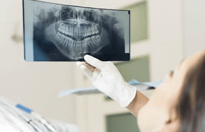 بانوراما للأسنان